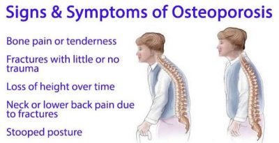 signs of osteoporosis