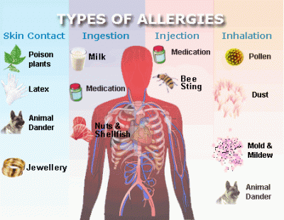 most common types of allergies