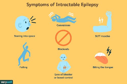 signs of epilepsy