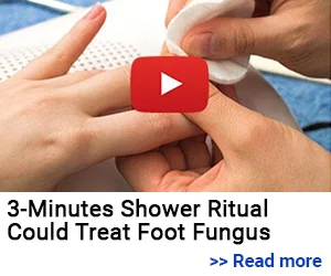 toenail fungus remover